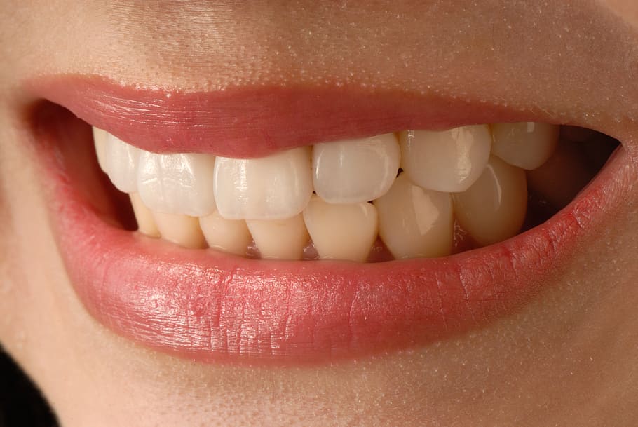 trattamento sbiancante denti